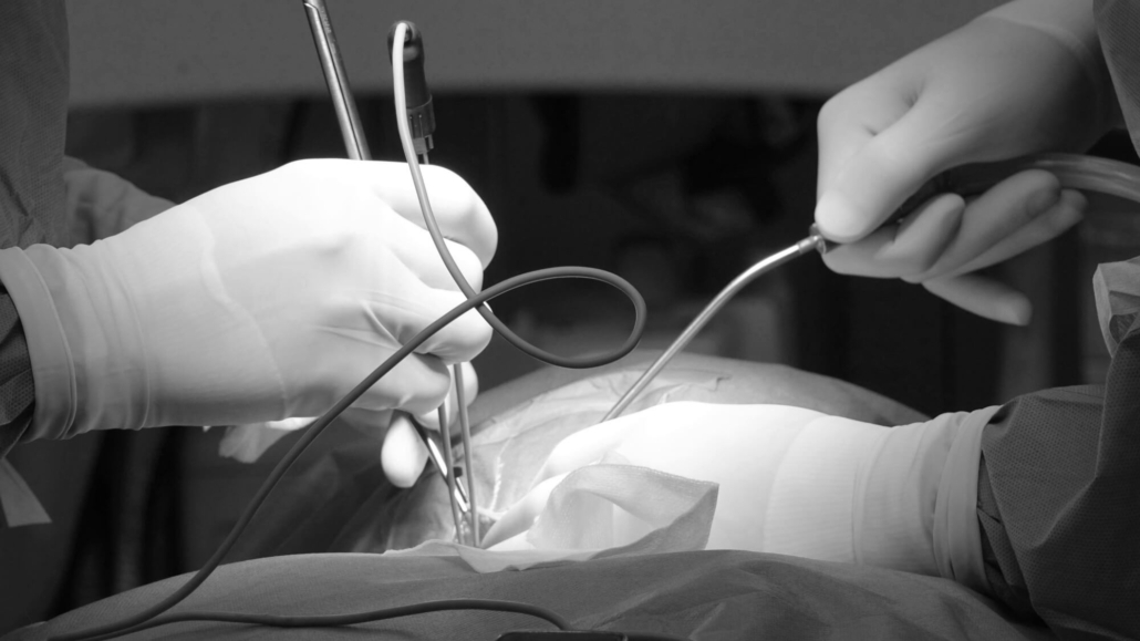 chirurgie-colonne-vertebrale-1