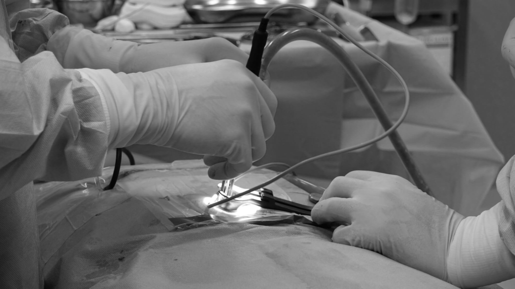 chirurgie-colonne-vertebrale